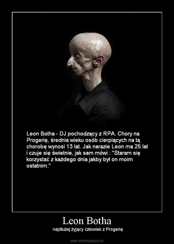 Leon Botha –  najdłużej żyjący człowiek z Progerią 
