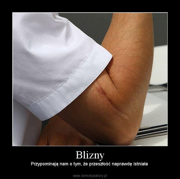 Blizny –  Przypominają nam o tym, że przeszłość naprawdę istniała   