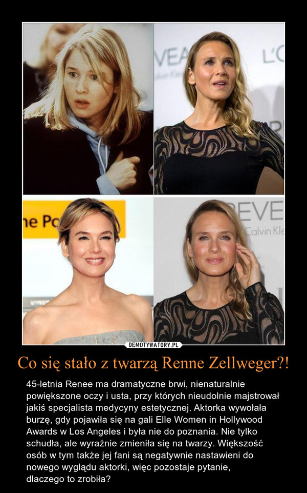 Co się stało z twarzą Renne Zellweger?!