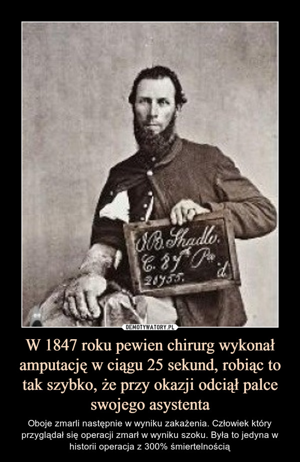 W 1847 roku pewien chirurg wykonał amputację w ciągu 25 sekund, robiąc to tak szybko, że przy okazji odciął palce swojego asystenta