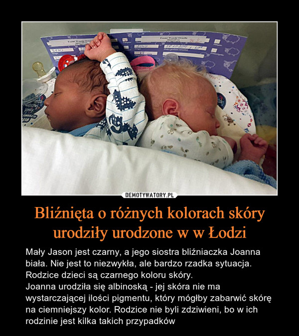 Bliźnięta o różnych kolorach skóry urodziły urodzone w w Łodzi