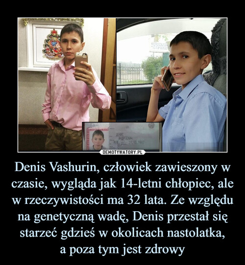 Denis Vashurin, człowiek zawieszony w czasie, wygląda jak 14-letni chłopiec, ale w rzeczywistości ma 32 lata. Ze względu na genetyczną wadę, Denis przestał się starzeć gdzieś w okolicach nastolatka,
a poza tym jest zdrowy