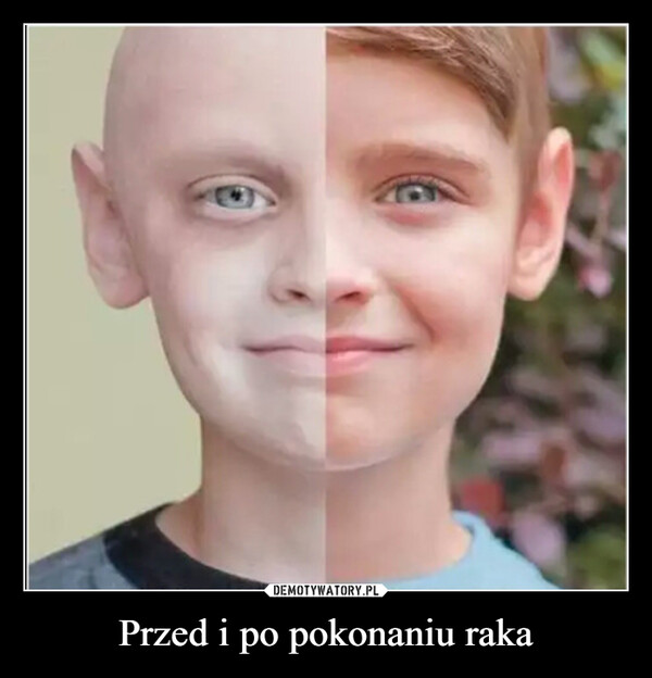 Przed i po pokonaniu raka –  